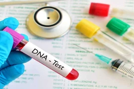 Khó xét nghiệm AND hài cốt liệt sỹ 