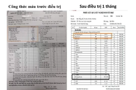 Phác đồ Lenalidomide – Dexamethasol liều thấp cứu bệnh nhân suy tủy do đa u tủy xương