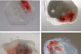 Tinh dịch màu gỉ sắt