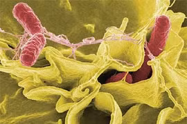 Biến chứng chết người do vi khuẩn Shigella