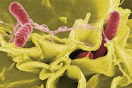 Biến chứng chết người do vi khuẩn Shigella