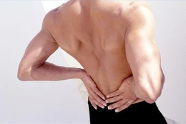 Đau lưng kéo dài do viêm cột sống dính khớp