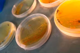 Vi khuẩn Salinispora nuôi cấy trong Phòng thí nghiệm Moore tại Viện Hải dương học Scripps của UC San Diego. Ảnh: Erik Jepsen/UC San Diego