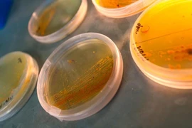 Vi khuẩn Salinispora nuôi cấy trong Phòng thí nghiệm Moore tại Viện Hải dương học Scripps của UC San Diego. Ảnh: Erik Jepsen/UC San Diego