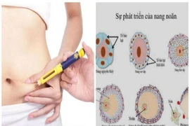 Nguy cơ khi kích trứng để sinh đôi