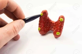 Phẫu thuật không có lợi ích gì ở bệnh nhân cường cận giáp nhẹ