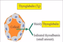  Anti-Thyroglobulin tăng có phải ung thư?