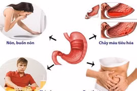 Không dùng men tiêu hóa khi đau dạ dày 