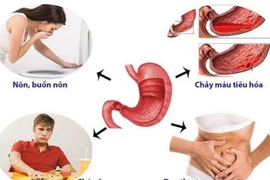 Không dùng men tiêu hóa khi đau dạ dày 