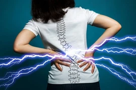  Đau lưng do thiếu vận động