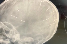 Ông nội bé gái 3 tuổi nghi bị bạo hành cầu cứu Tổng đài bảo vệ trẻ em