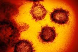 Virus gây COVID-19 đột biến giống HIV, xâm nhập mạnh gấp 1.000 lần SARS