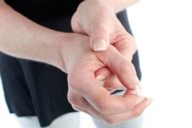 Hội chứng De Quervain