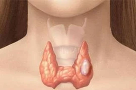 Mổ nội soi và mổ mở tuyến giáp