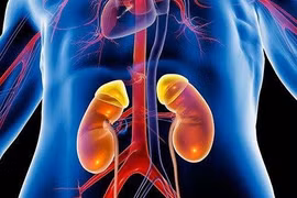 5 dấu hiệu suy thận cấp điển hình bạn không thể bỏ qua