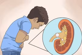 Hội chứng thận hư lại tưởng con bụ bẫm 