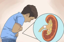 Hội chứng thận hư lại tưởng con bụ bẫm 