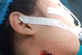 Gia tăng trẻ nghỉ học ở nhà gặp tai nạn