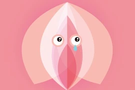 Bụng to do màng trinh bít kín