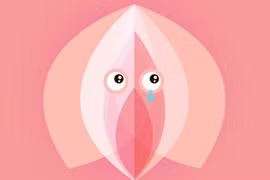 Bụng to do màng trinh bít kín