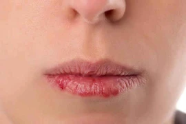 Nhìn miệng đoán bệnh