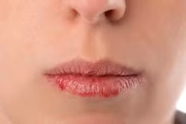 Nhìn miệng đoán bệnh