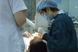 Rụng răng vì thuốc tẩy trắng răng