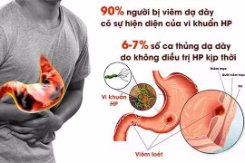 Cách trị loét dạ dày có HP