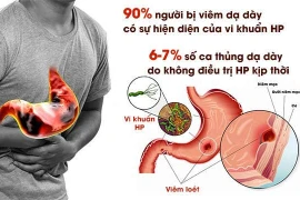 Cách trị loét dạ dày có HP
