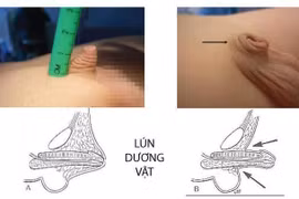 Điều trị sai hại con
