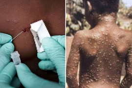 Virus đậu mùa khỉ nhiều đột biến không ngờ 
