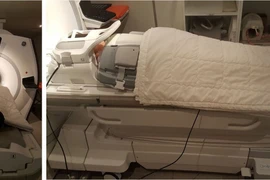 Cộng hưởng từ toàn thân tầm soát ung thư di căn