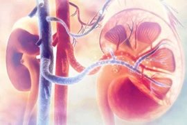 Bệnh viêm cầu thận mạn có chữa khỏi được không?