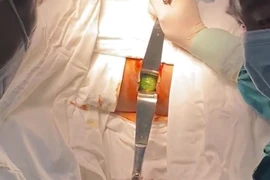 Ca hiếm gặp: Tự sướng, dưa leo kẹt lại trong hậu môn 