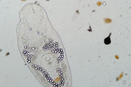 Nghiên cứu ký sinh trùng để ngăn ngừa đại dịch