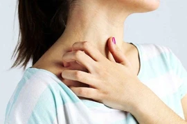 Trị ngứa da mùa đông bằng giữ ấm