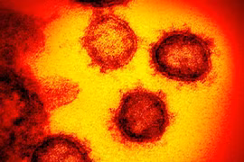 2 kháng thể trung hòa có thể chống SARS-CoV-2