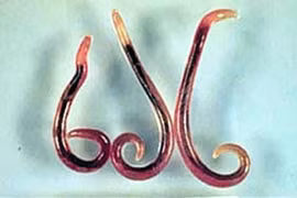 Dễ tử vong nếu nhiễm giun đầu gai