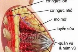 Rửa ống tuyến vú phát hiện sớm ung thư