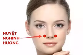 Xoa bóp, châm cứu điều trị viêm mũi dị ứng