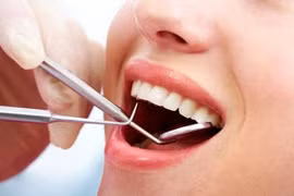 Chảy máu chân răng