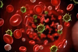 Ghép tế bào gốc trong hội chứng loạn sản tủy