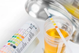 4 nhóm nguyên nhân gây tiểu máu