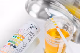 4 nhóm nguyên nhân gây tiểu máu