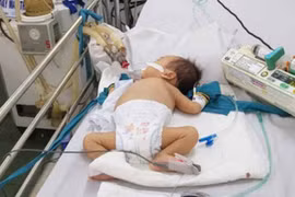 Bác sĩ Nhi cảnh báo triệu chứng đầu tiên của bệnh tay chân miệng, cha mẹ cần chú ý