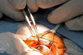 Sau phẫu thuật phải ngừng thể thao?