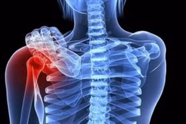 U xương bả vai có phải ung thư?