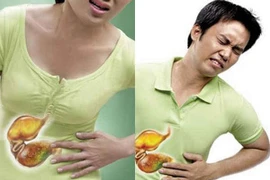 Có cách nào không cần nội soi vẫn tầm soát được ung thư dạ dày?