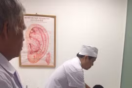 Cấy ghép kích thích huyệt đạo liên tục chữa thoát vị đĩa đệm cột sống