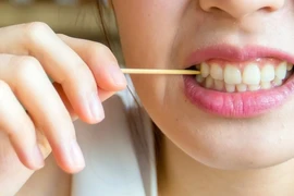 Chăm vệ sinh răng mà vẫn sâu